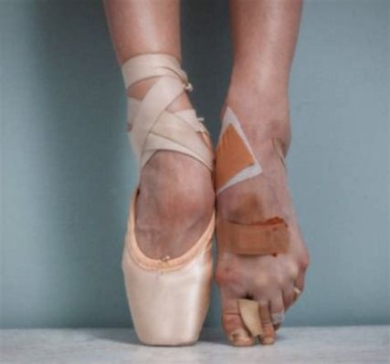 does ballet mess up your feet does ballet really ruin your feet?